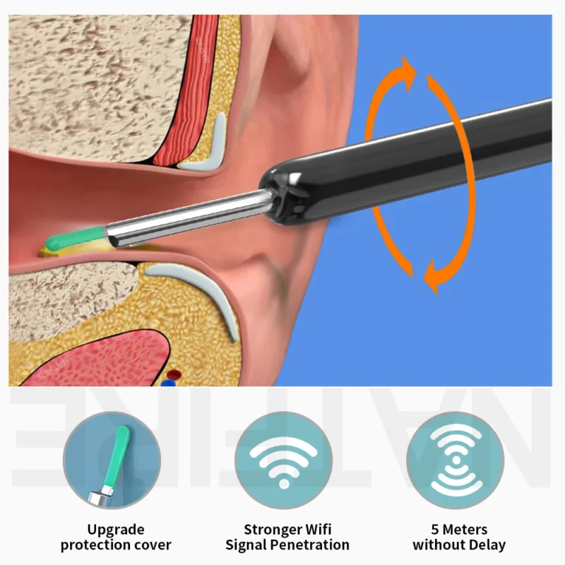 Smart Visual Ear Cleaner HD Ear Sticks Otoscope USB C Charging Endoscope Wax Removal Tool Earpick MIni Camera Health Care Set - Image 2